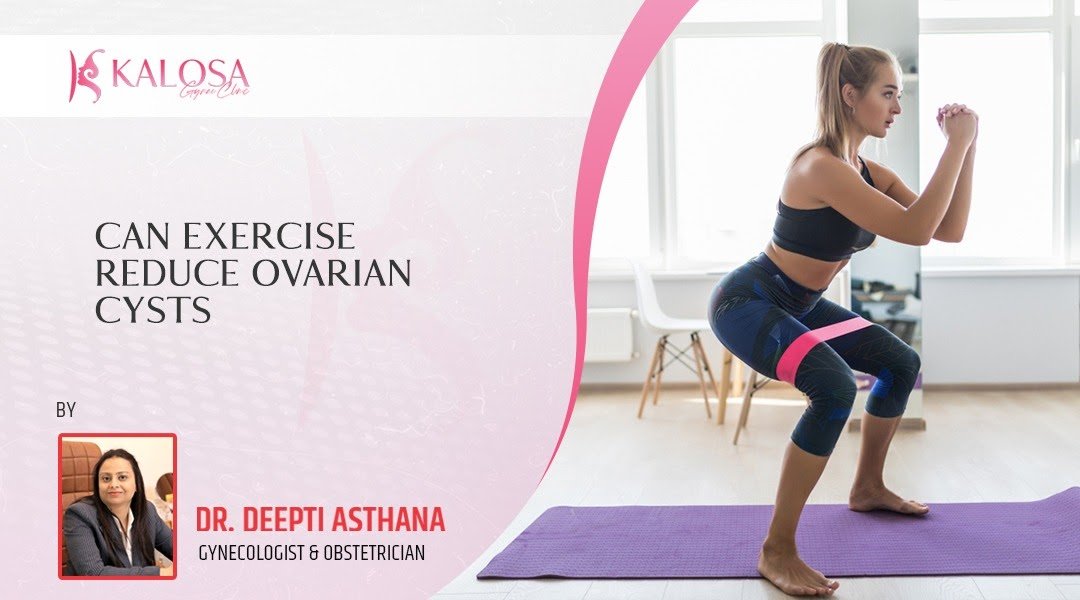 can-exercise-reduce-ovarian-cysts